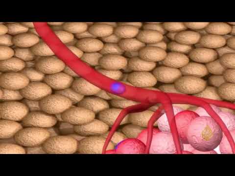 هذا الصباح - دراسة: الخمور تدمر الخلايا وتسبب السرطان
