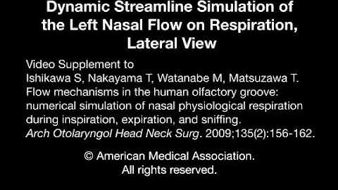 Dynamic Streamline Simulation of Nasal Flow 1