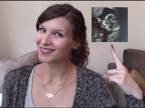 Pregnancy Tag! | First Pregnancy
