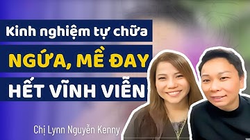 Kinh Nghiệm Tự Chữa NGỨA, MỀ ĐAY, DỊ ỨNG Vĩnh Viễn Không Tái Phát - Thầy Thuốc Tự Thân