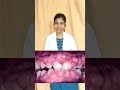 #hypertension #highbp #highbptablets #teluguhealthtips #chigullavaapu #gumdisease #telugushorts