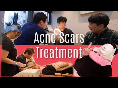 Acne Scars Treatment in Seoul - Let&#;s Get Korean Skin!