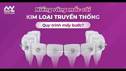 Quy Trình Niềng Răng Mắc Cài Kim Loại - Nha Khoa My Auris