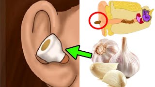 معجزة سبحان الله..!! هذا ما يحدث لو وضعت الثوم في أذنك..؟ فوائد الثوم