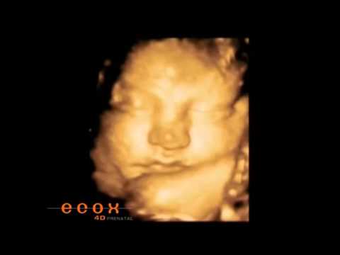 De de 35 semanas de embarazo ecografias imagenes