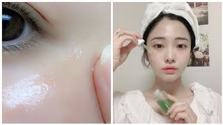 ازالة الهالات السوداء نهائياً Remove dark circles in two days+نصائح للهالات + سبب الهالات