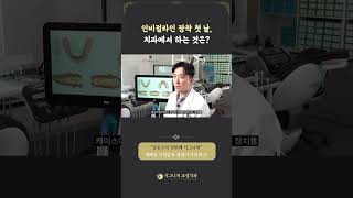 인비절라인 장착 첫 날, 치과에서 하는 것은?