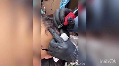 SCALPA MICROPIGMENTATION