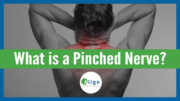How a Pinched Nerve Happens & What to Do About It