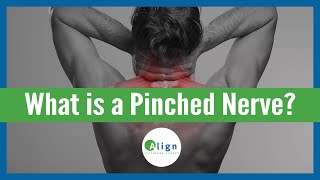 How a Pinched Nerve Happens & What to Do About It by Align Wellness Center 3,474 views 1 year ago 2 minutes, 41 seconds