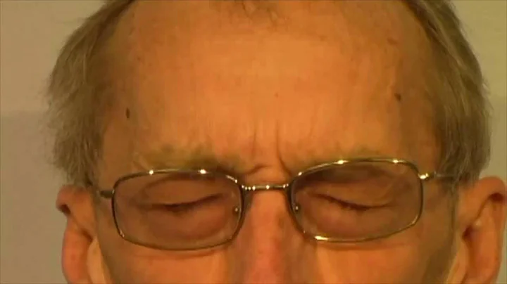 Upper Facial Chorea in Patients with Huntington's ...