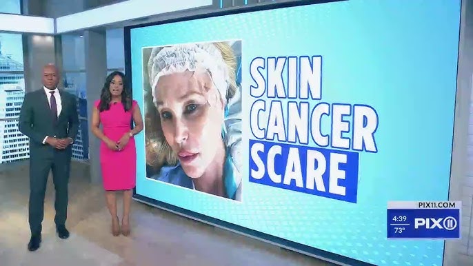 Christie Brinkley Skin Cancer Scare