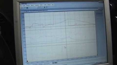 Chads S2000 580WHP Dyno Vid