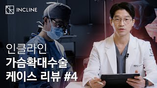 인클라인 가슴확대수술 케이스 리뷰 #4