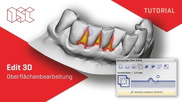 OnyxCeph³™ - Modul Edit 3D
