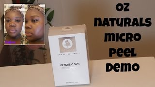 Oz Naturals Micro Peel First Impressions/Demo|MissRessaT