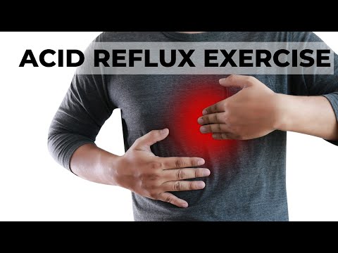 Video: 3 maniere om te slaap met acid reflux