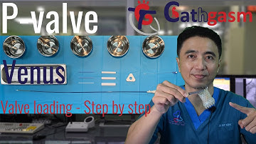 Venus P-valve loading | Step by step guide