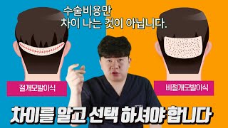모발이식 절개 비절개 장단점 /모발이식흉터/후두부밀도/회복기간  루트원장 박상현외과전문의가 소개합니다.