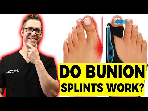 Видео: Трябва ли да нося чорапи с обувки Toms?