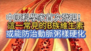 Download Lagu 中國科學家首次發現!這一常見的B族維生素或能防治動脈粥樣硬化 Download Lagu 中國科學家首次發現!這一常見的B族維生素或能防治動脈粥樣硬化