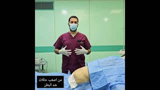 من اصعب حالات شد البطن الجراحي بعد ولادات متكررة tummytucksurgery