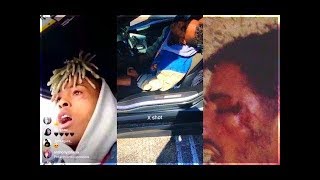 شاهد اخر ما قاله مغني الراب Xxxtentacion  قبل وفاته  كأنه يعلم أنه سيقتل