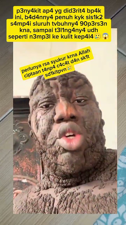 bersyukur kita yg dbrikn bdan sehat tanpa s4k1t sdikitpun 🥲 #fypviral #trendingshorts