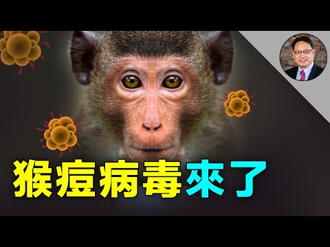 猴痘病毒首次在非洲以外傳播，有一類人容易感染，要特別警惕。