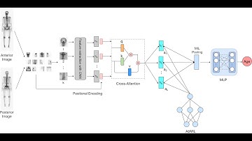 ICPR2022 || Bone Age Estimation with Multiple Instance Learning
