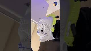 Bvxa Tp Hcm  Mt N Trong X Tr Ti Khu iu Tr Ung Bu K Thut Cao Xuyn 