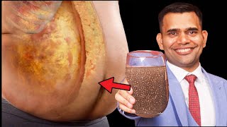 Eat Chia Seeds To Lose Weight Fast | Best Way To Eat Chia Seeds For Quick Weight loss