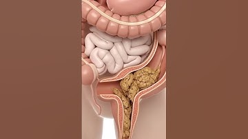 Constipation Explained  3D Animation & Human Anatomy #meded #anatomy #3dmodel
