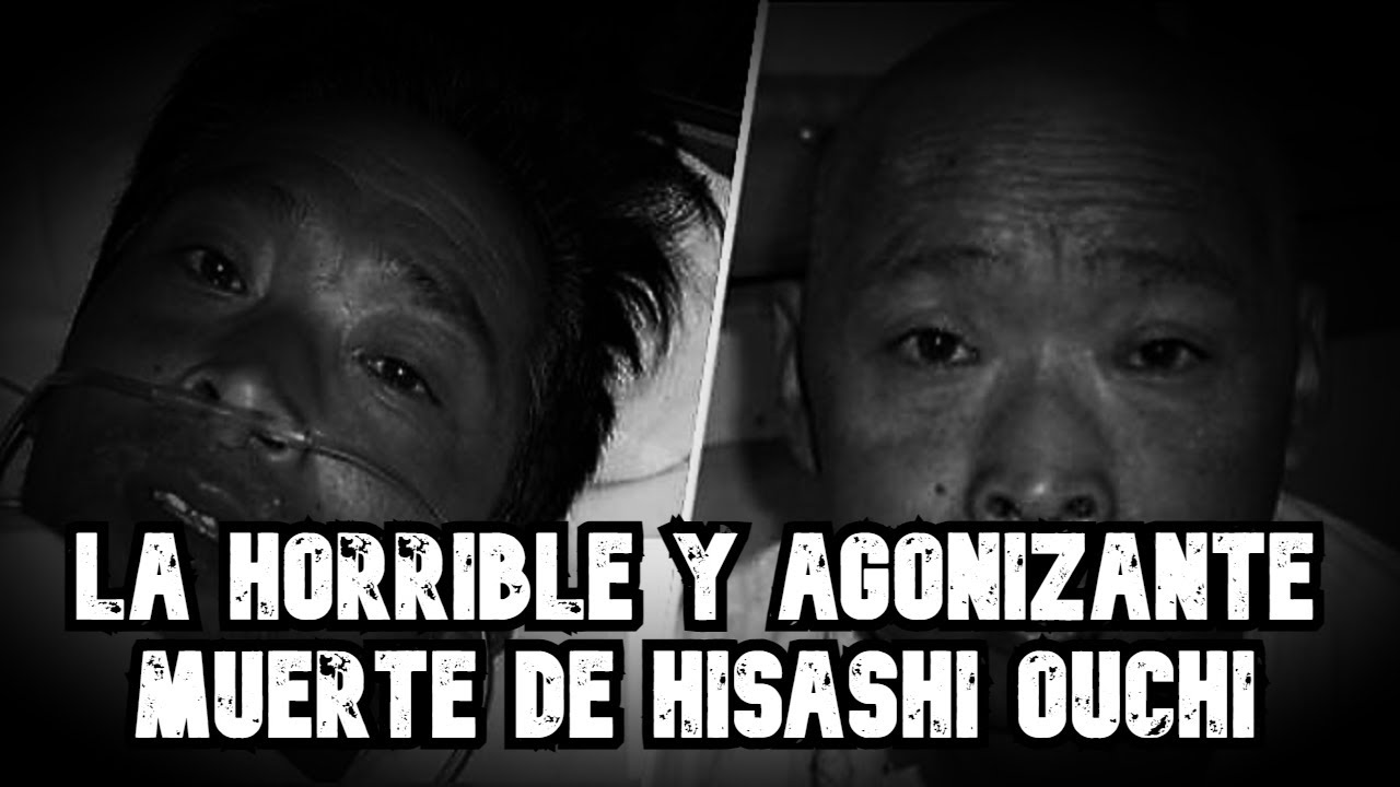 La horrible y agonizante muerte de Hisashi Ouchi YouTube