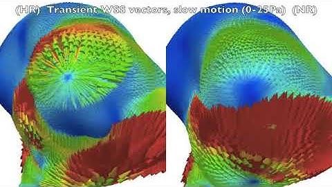 Wall shear stress instabilities in a cerebral aneurysm
