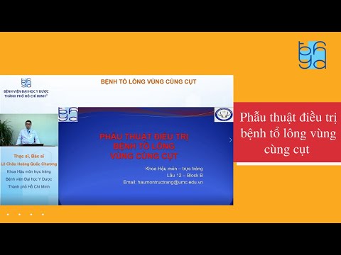 Video: 3 cách để điều trị u nang Pilonidal