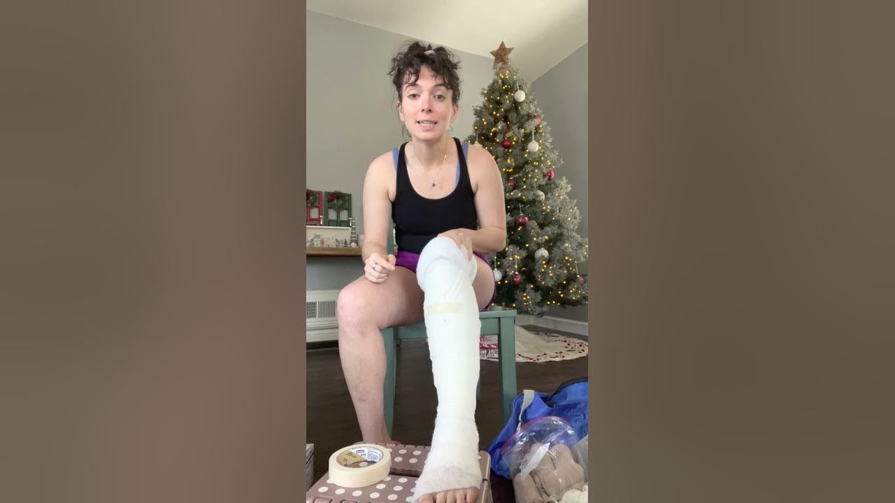 SelfBandaging of Lower Leg for Lymphedema YouTube