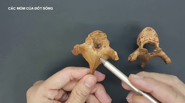 Cấu tạo cơ bản của một đốt sống