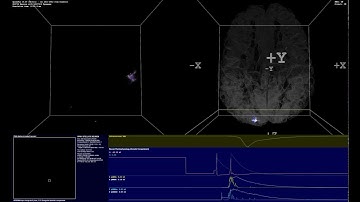 SpikeFun - Single Neuron Stimulation Impact on Simulated Brain Network