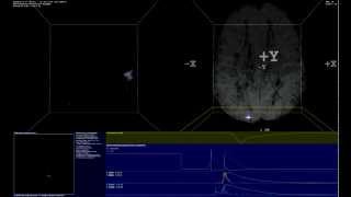 SpikeFun - Single Neuron Stimulation Impact on Simulated Brain Network