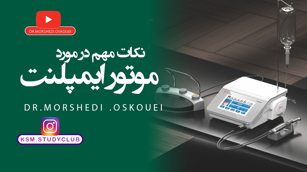 نکات مهم تنظیمات موتور ایمپلنت