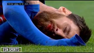 Cristiano Ronaldo, Messi & Neymar l Horror Fouls,Bleeding l 1080i HD