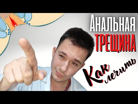 Анальная трещина. Лечение!