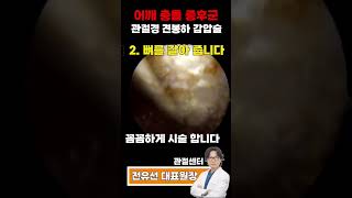 어깨충돌중후군 [관절경 견봉하 감압술]