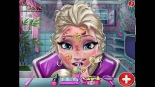 Disney Frozen game: Elsa Skin Doctor - Doctor games for girls