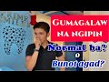 PERIODONTITIS: Gumagalaw na ngipin?