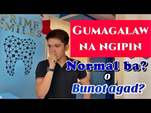 Video: 3 Mga Paraan upang Magsipilyo ng Iyong mga Ngipin Nang Hindi Gumagamit Ng Toothpaste