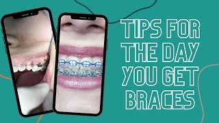 Tips for the Day You Get Braces #shorts