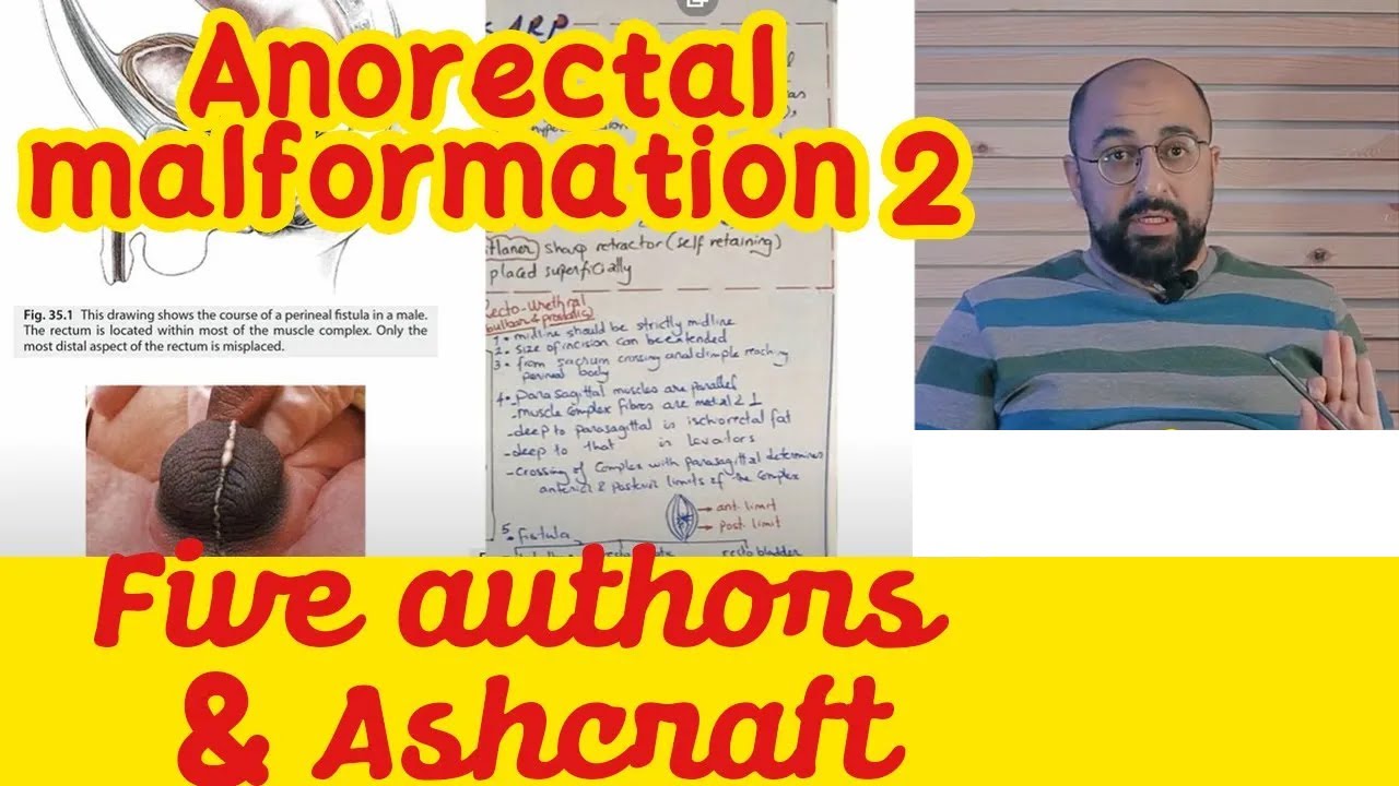 Ep 2 - Anorectal Malformation -  Five Authors & Ashcraft انسدادالشرج   (Alberto Pena)