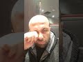 الفرق بين فرك العين المسموح والممنوع دكتور محمد جودة الفرق بين فرك العين المسموح والممنوع دكتور محمد جودة